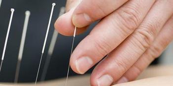 Acupuncture degree in CT